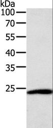 SNAP25 Antibody - Western blot analysis of HeLa cell, using SNAP25 Polyclonal Antibody at dilution of 1:400.