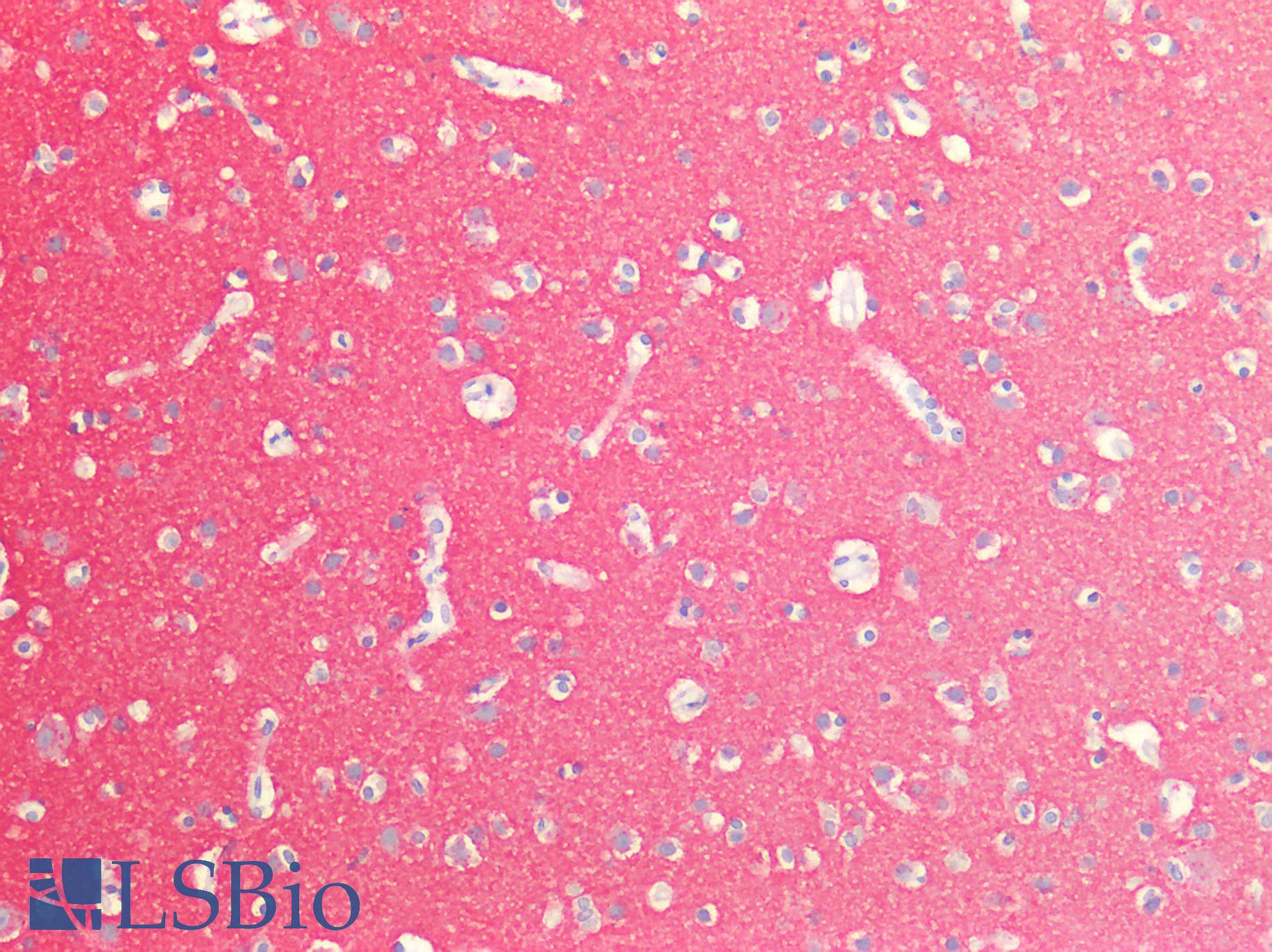 SNAP25 Antibody - Human Brain, Cortex: Formalin-Fixed, Paraffin-Embedded (FFPE)