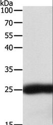 SNAP25 Antibody - Western blot analysis of HeLa cell, using SNAP25 Polyclonal Antibody at dilution of 1:400.