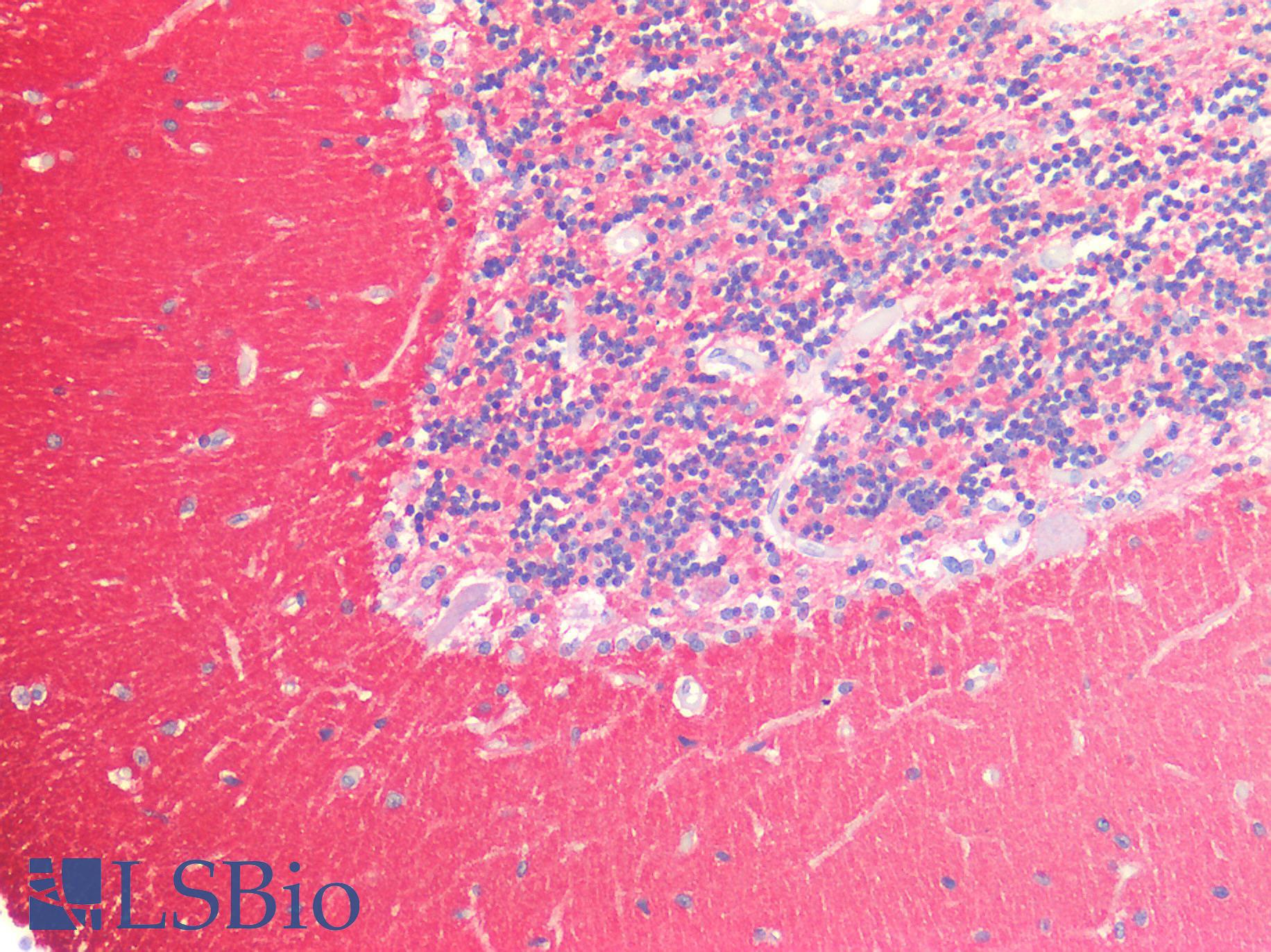 SNAP25 Antibody - Human Brain, Cerebellum: Formalin-Fixed, Paraffin-Embedded (FFPE)