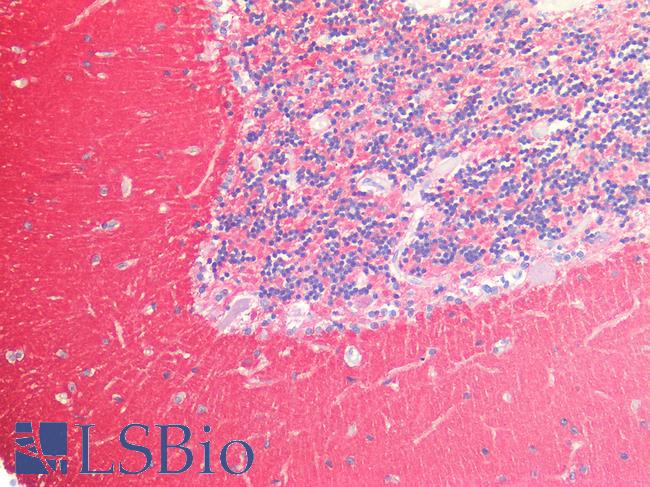 SNAP25 Antibody - Human Brain, Cerebellum: Formalin-Fixed, Paraffin-Embedded (FFPE)