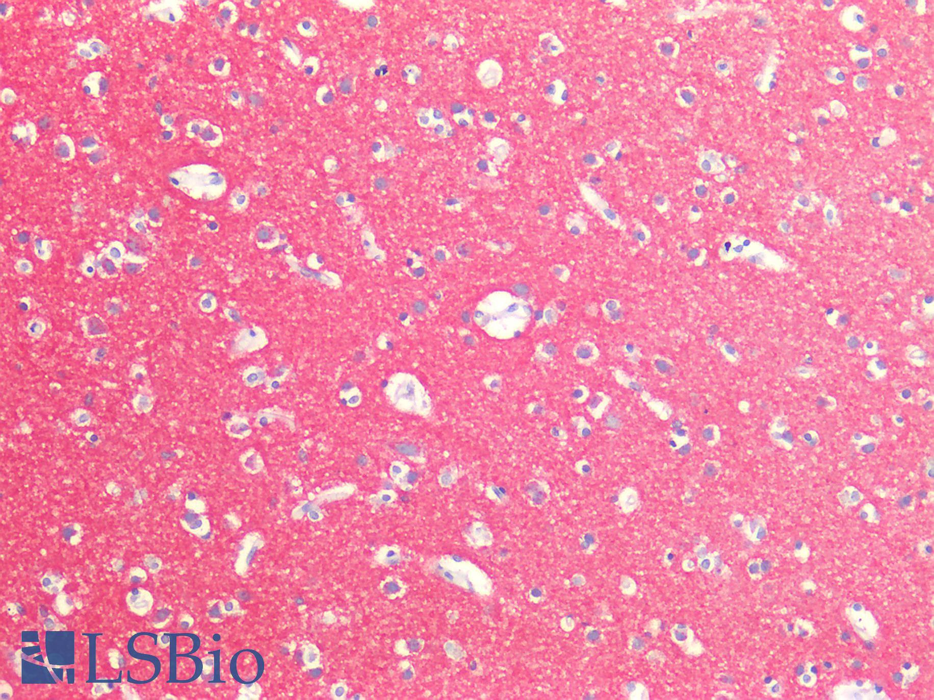 SNAP25 Antibody - Human Brain, Cortex: Formalin-Fixed, Paraffin-Embedded (FFPE)