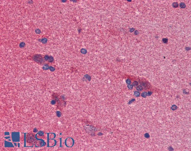 SNCA / Alpha-Synuclein Antibody - Anti-SNCA / Alpha-Synuclein antibody IHC of human brain, cortex. Immunohistochemistry of formalin-fixed, paraffin-embedded tissue after heat-induced antigen retrieval. Antibody concentration 10 ug/ml.