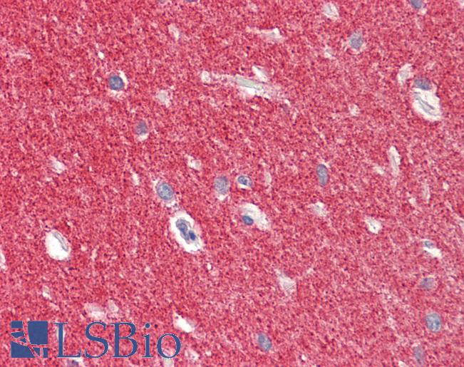 SNCA / Alpha-Synuclein Antibody - Anti-SNCA / Alpha-Synuclein antibody IHC staining of human brain, cerebellum. Immunohistochemistry of formalin-fixed, paraffin-embedded tissue after heat-induced antigen retrieval. Antibody concentration 5 ug/ml.