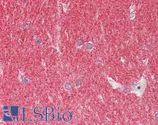 SNCA / Alpha-Synuclein Antibody - Anti-SNCA / Alpha-Synuclein antibody IHC staining of human brain, cerebellum. Immunohistochemistry of formalin-fixed, paraffin-embedded tissue after heat-induced antigen retrieval. Antibody concentration 5 ug/ml.