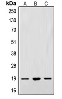 SNCA / Alpha-Synuclein Antibody - Western blot analysis of Alpha-synuclein expression in A549 (A); SKNSH (B); PC12 (C) whole cell lysates.