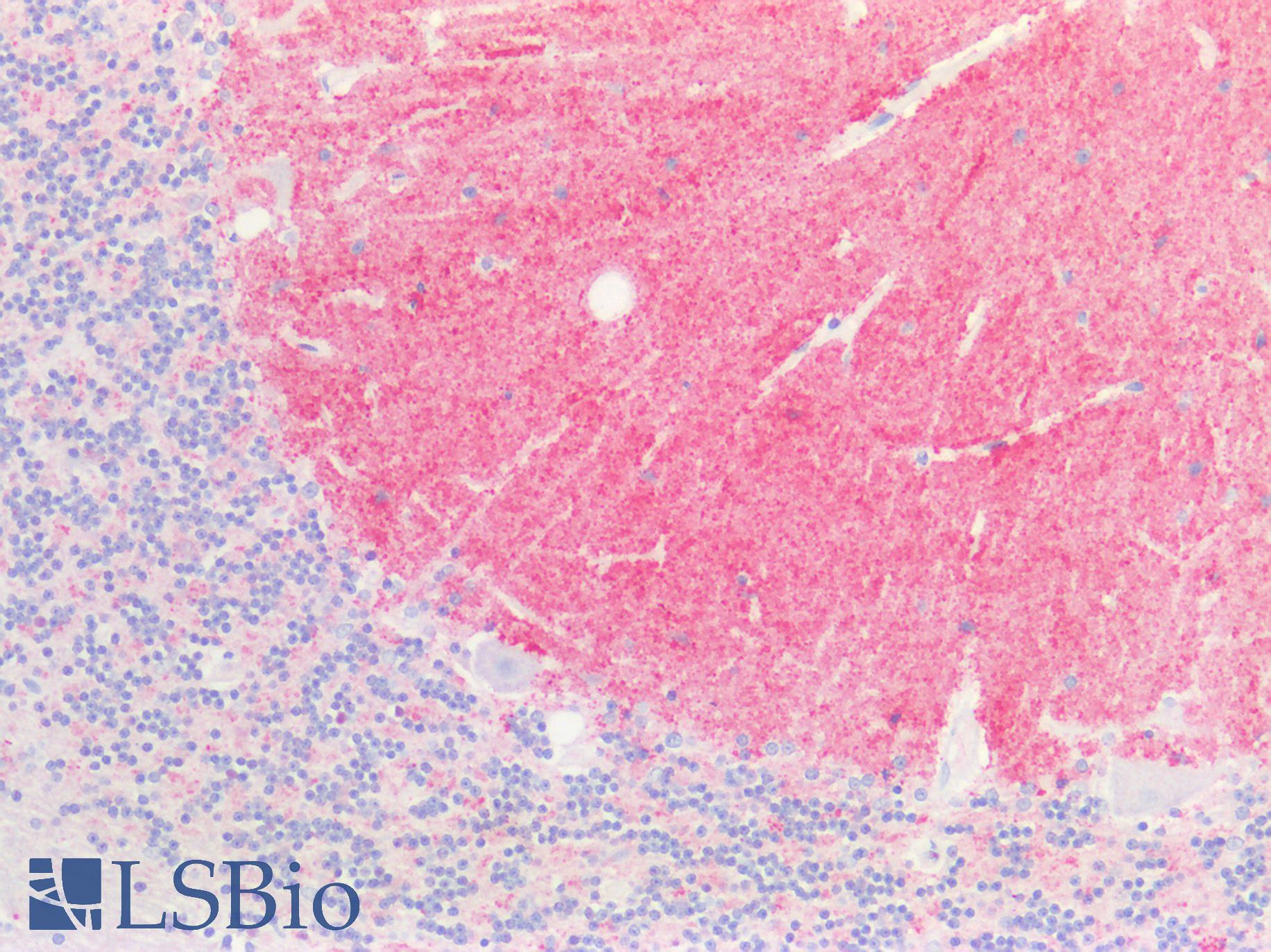 SNCA / Alpha-Synuclein Antibody - Human Brain, Cerebellum: Formalin-Fixed, Paraffin-Embedded (FFPE)