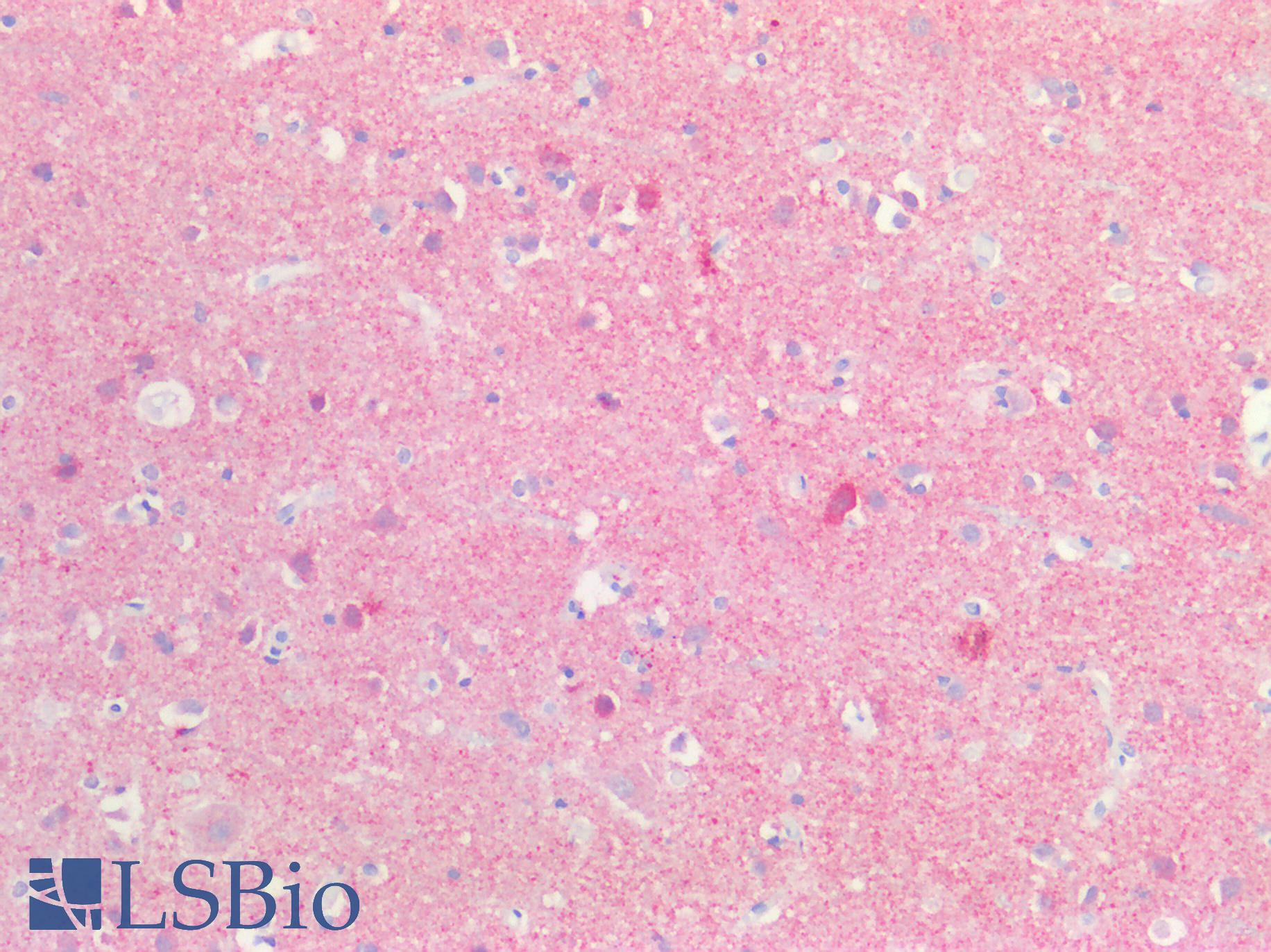 SNCA / Alpha-Synuclein Antibody - Human Brain, Cortex: Formalin-Fixed, Paraffin-Embedded (FFPE)