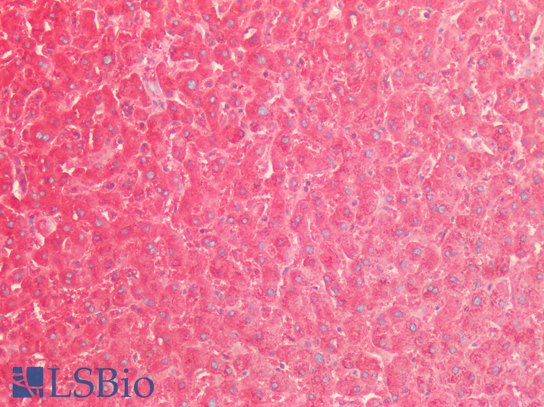 SOD2 / Mn SOD Antibody - Human Liver: Formalin-Fixed, Paraffin-Embedded (FFPE)