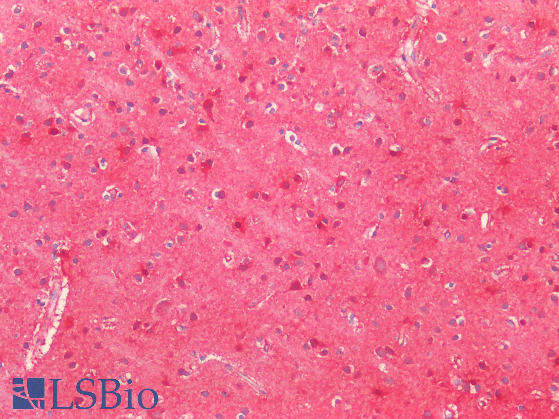 SOD2 / Mn SOD Antibody - Human Brain, Cortex: Formalin-Fixed, Paraffin-Embedded (FFPE)