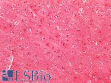 SOD2 / Mn SOD Antibody - Human Brain, Cortex: Formalin-Fixed, Paraffin-Embedded (FFPE)