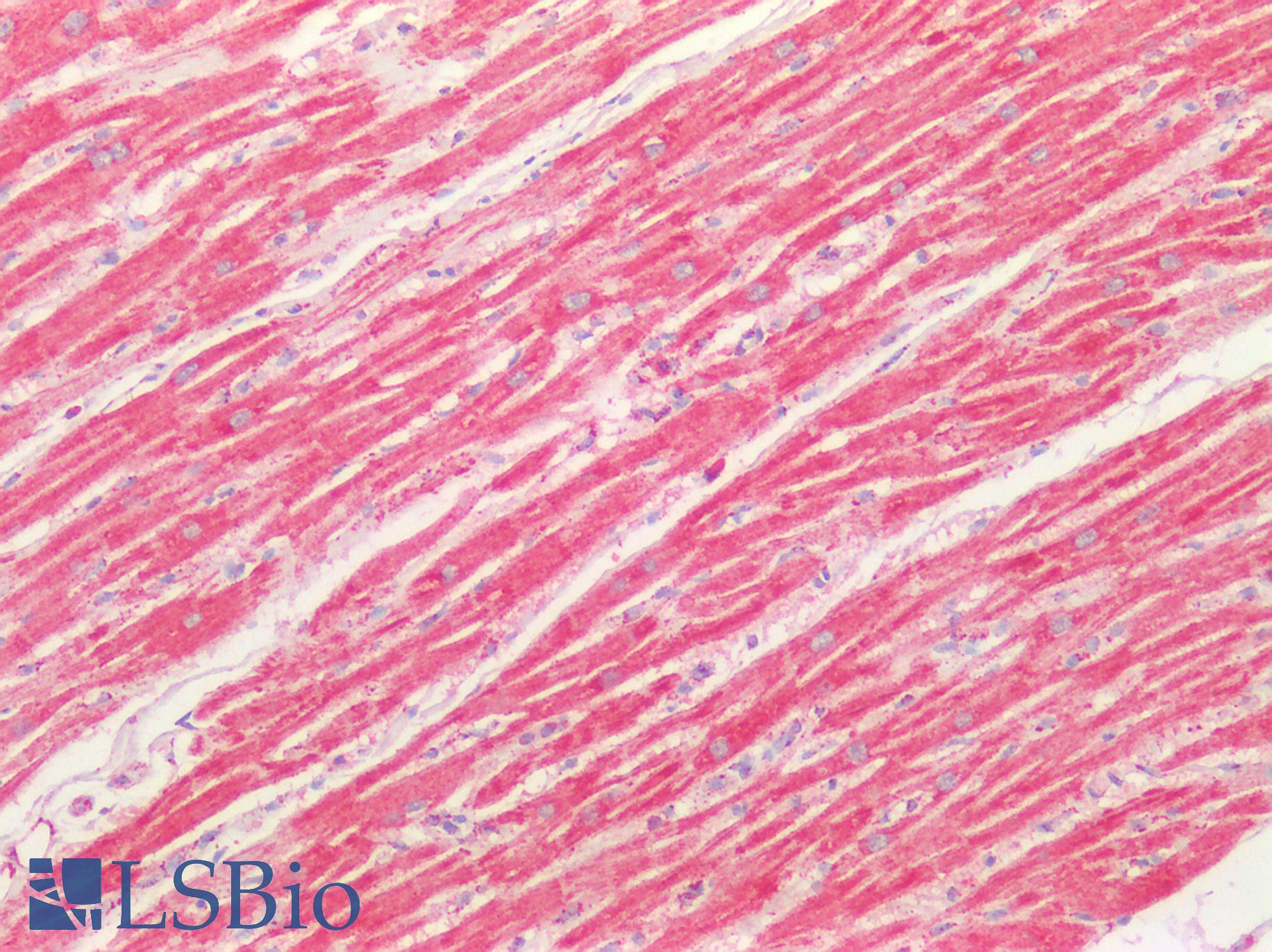 SOD2 / Mn SOD Antibody - Human Heart: Formalin-Fixed, Paraffin-Embedded (FFPE)