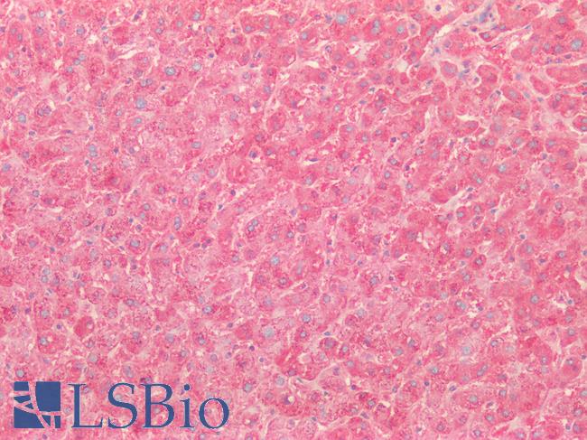SOD2 / Mn SOD Antibody - Human Liver: Formalin-Fixed, Paraffin-Embedded (FFPE)