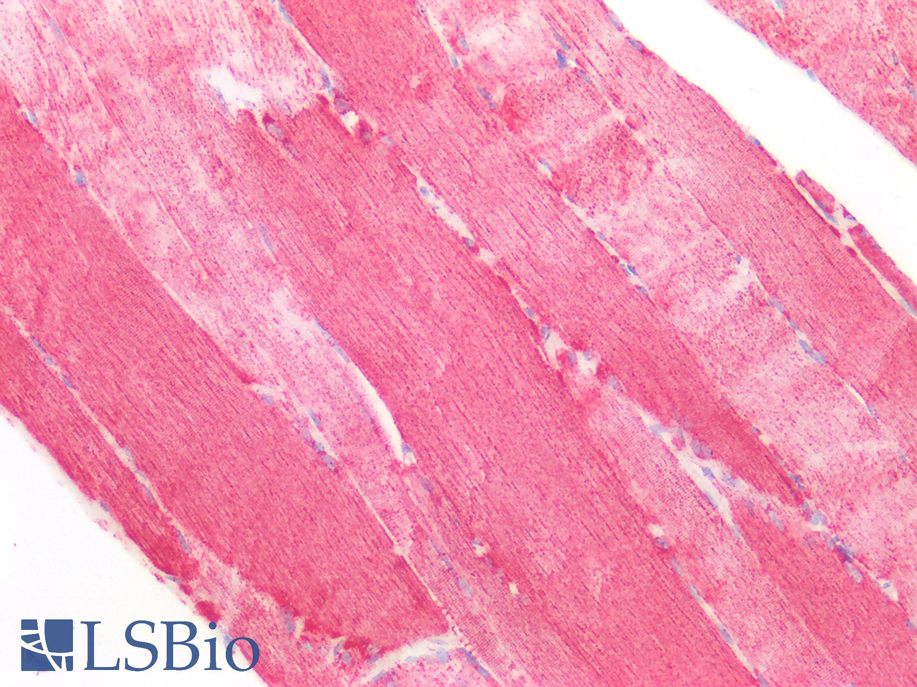 SOD2 / Mn SOD Antibody - Human Skeletal Muscle: Formalin-Fixed, Paraffin-Embedded (FFPE)