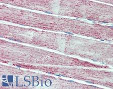 SOD2 / Mn SOD Antibody - Anti-MNSOD / SOD2 antibody IHC staining of human skeletal muscle. Immunohistochemistry of formalin-fixed, paraffin-embedded tissue after heat-induced antigen retrieval.