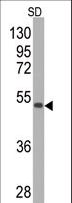 SOD2 / Mn SOD Antibody - Western blot of anti-SOD2 Monoclonal Antibody by SOD2-GST fusion protein (GST MW=26 kD. SOD2-GST fusion protein (arrow) was detected using the purified antibody. (1:2000)