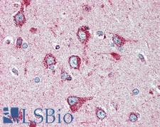 SOD2 / Mn SOD Antibody - Anti-SOD2 / MNSOD antibody IHC of human brain, cortex. Immunohistochemistry of formalin-fixed, paraffin-embedded tissue after heat-induced antigen retrieval. Antibody dilution 1:50.