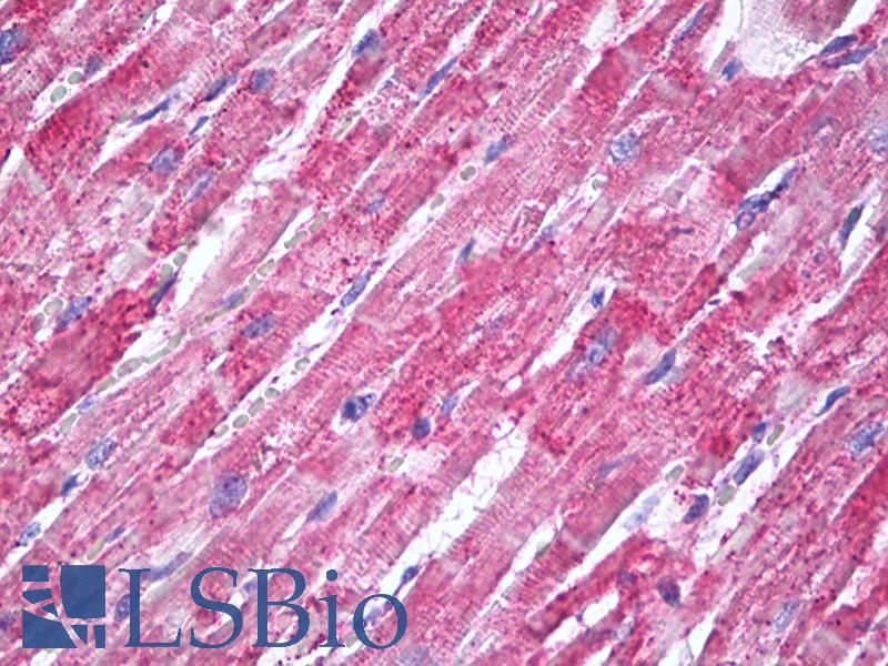 SOD2 / Mn SOD Antibody - Anti-MNSOD / SOD2 antibody IHC of human heart. Immunohistochemistry of formalin-fixed, paraffin-embedded tissue after heat-induced antigen retrieval. Antibody dilution 10 ug/ml.  This image was taken for the unconjugated form of this product. Other forms have not been tested.