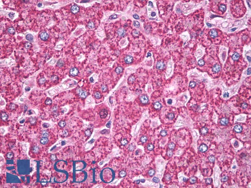 SOD2 / Mn SOD Antibody - Anti-MNSOD / SOD2 antibody IHC of human liver. Immunohistochemistry of formalin-fixed, paraffin-embedded tissue after heat-induced antigen retrieval. Antibody dilution 10 ug/ml.  This image was taken for the unconjugated form of this product. Other forms have not been tested.