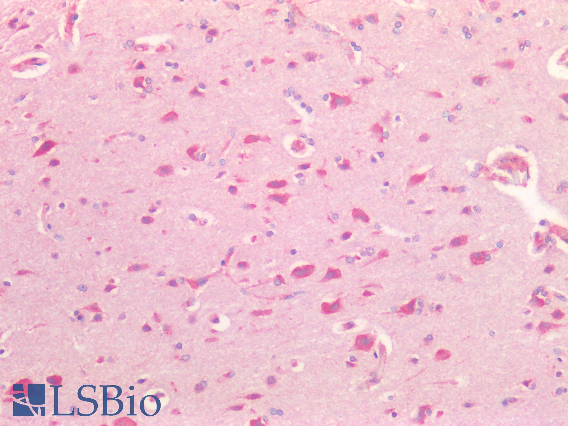 SORT1 / Sortilin Antibody - Human Brain, Cortex: Formalin-Fixed, Paraffin-Embedded (FFPE)