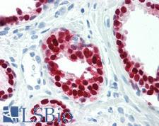 SOX9 Antibody - Human Prostate: Formalin-Fixed, Paraffin-Embedded (FFPE)