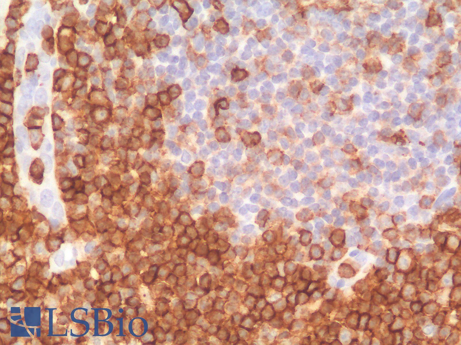 SPN / CD43 Antibody - Human Tonsil: Formalin-Fixed, Paraffin-Embedded (FFPE)