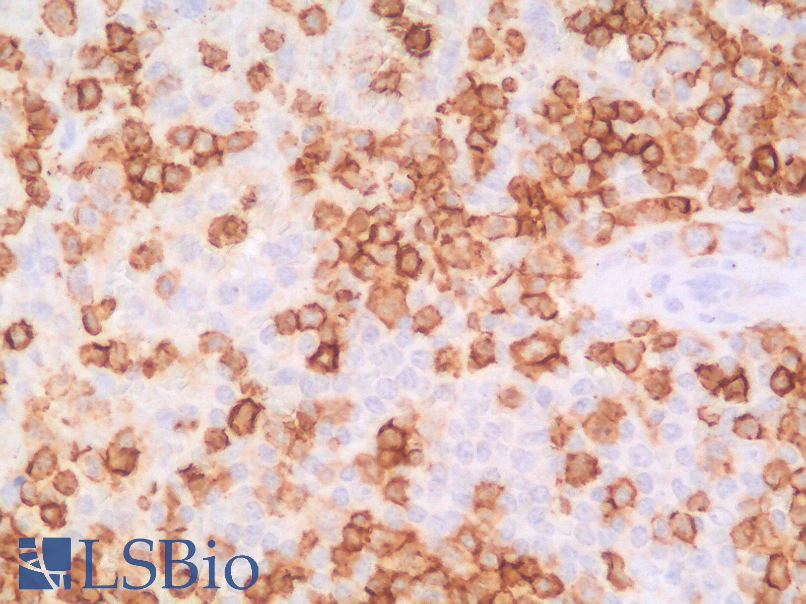 SPN / CD43 Antibody - Human Spleen: Formalin-Fixed, Paraffin-Embedded (FFPE)
