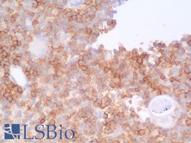 SPN / CD43 Antibody - Human Thymus: Formalin-Fixed, Paraffin-Embedded (FFPE)