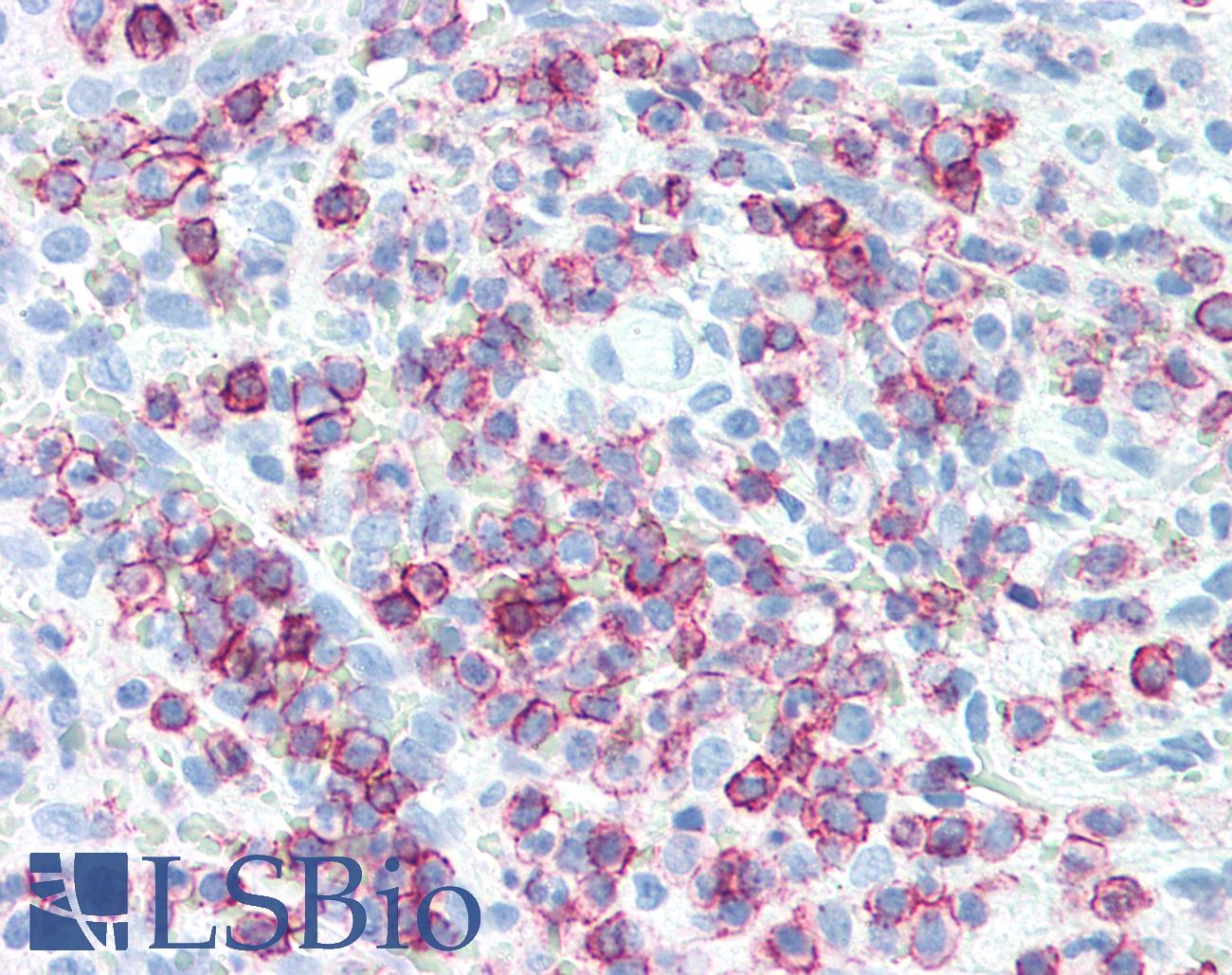 SPN / CD43 Antibody - Human Spleen: Formalin-Fixed, Paraffin-Embedded (FFPE)