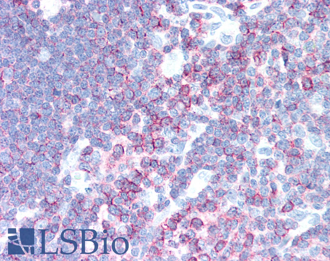 SPN / CD43 Antibody - Human Thymus: Formalin-Fixed, Paraffin-Embedded (FFPE)