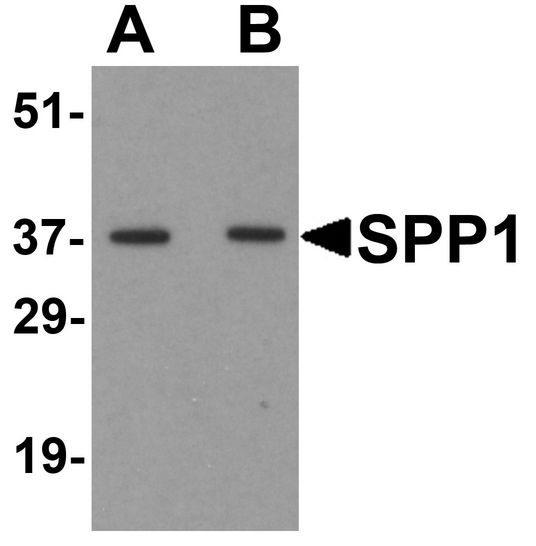 SPP1 / Osteopontin Antibody - Western blot analysis of SPP1 in human bladder tissue lysate with SPP1 antibody at (A) 1 and (B) 2 ug/ml.