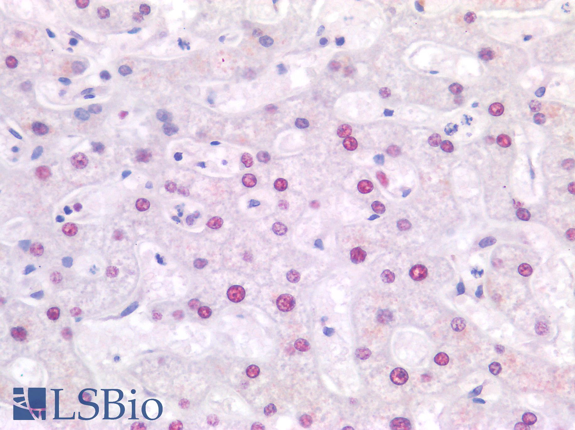 SSB / La Antibody - Human Liver: Formalin-Fixed, Paraffin-Embedded (FFPE)