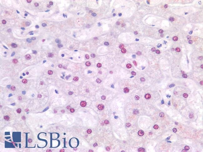 SSB / La Antibody - Human Liver: Formalin-Fixed, Paraffin-Embedded (FFPE)