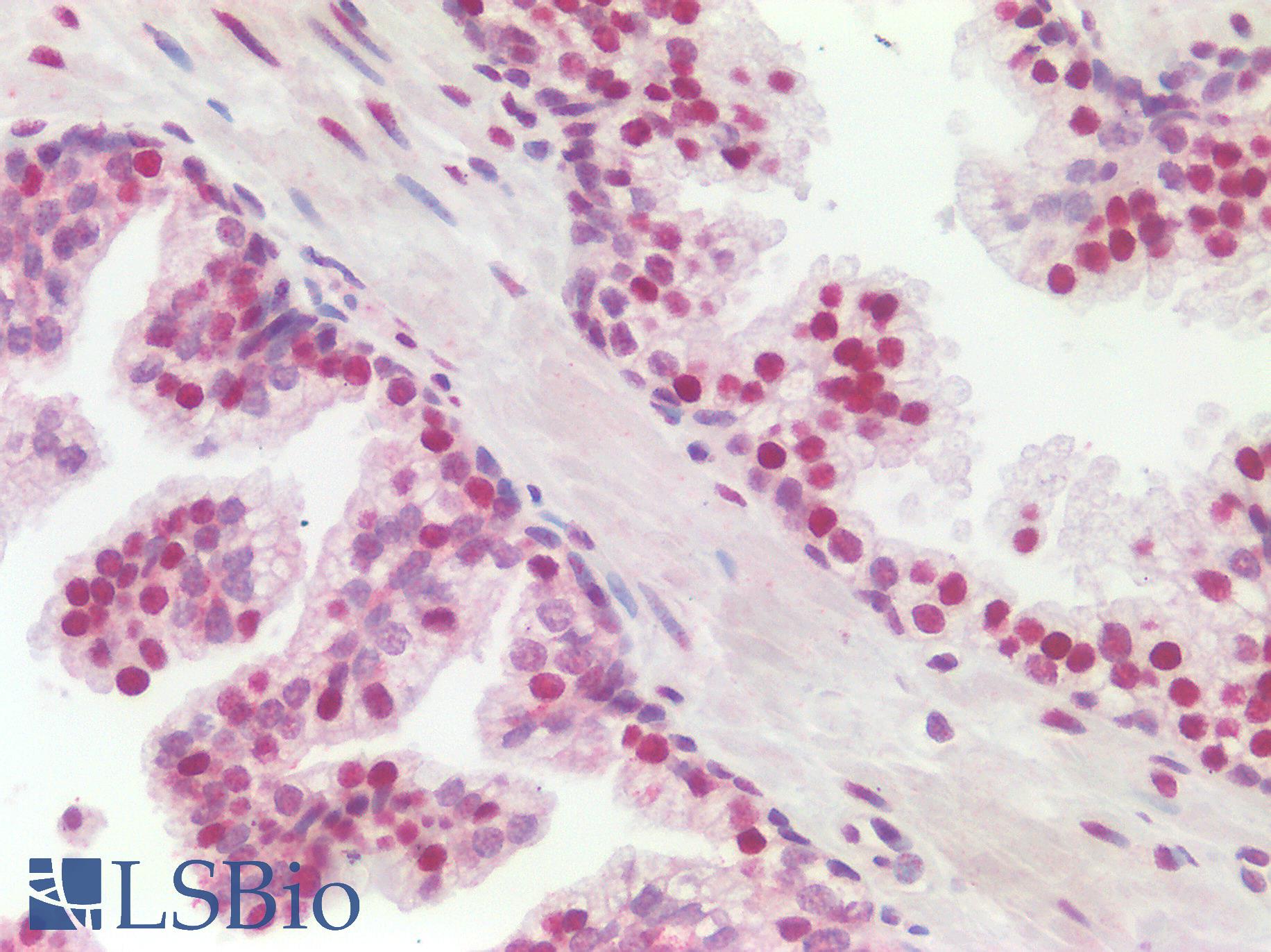 SSB / La Antibody - Human Prostate: Formalin-Fixed, Paraffin-Embedded (FFPE)