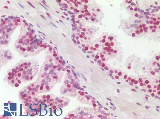 SSB / La Antibody - Human Prostate: Formalin-Fixed, Paraffin-Embedded (FFPE)