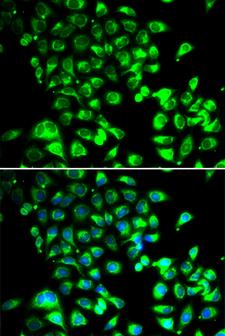SSBP1 / mtSSB Antibody - Immunofluorescence analysis of U2OS cells.