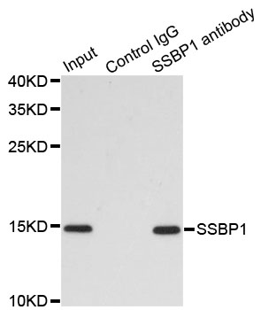 SSBP1 / mtSSB Antibody - Immunoprecipitation analysis of 200ug extracts of MCF7 cells.
