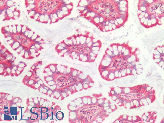 SSBP1 / mtSSB Antibody - Human Small Intestine: Formalin-Fixed, Paraffin-Embedded (FFPE)