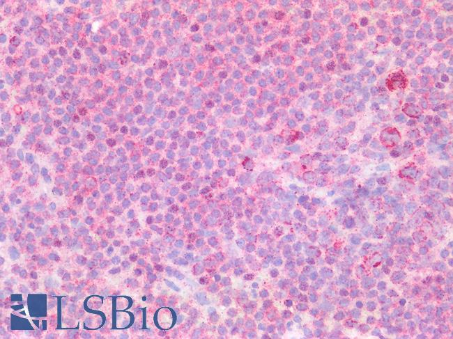SSBP1 / mtSSB Antibody - Human Spleen: Formalin-Fixed, Paraffin-Embedded (FFPE)