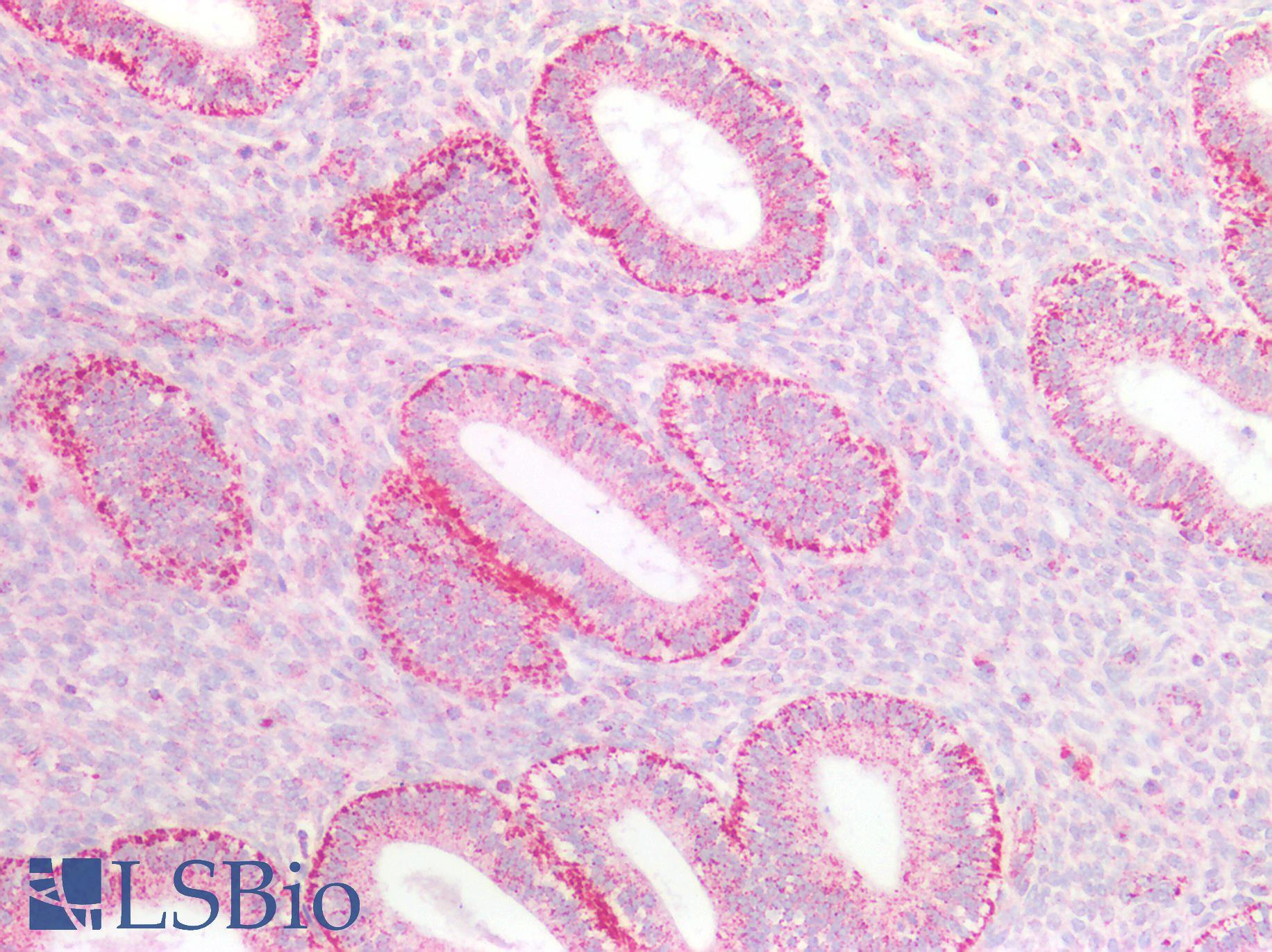 SSBP1 / mtSSB Antibody - Human Uterus: Formalin-Fixed, Paraffin-Embedded (FFPE)