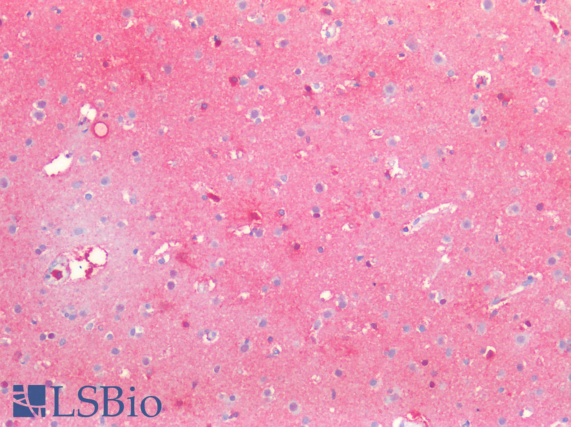 SSEA-1 / Lewis x / CD15 Antibody - Human Brain, Cortex: Formalin-Fixed, Paraffin-Embedded (FFPE)
