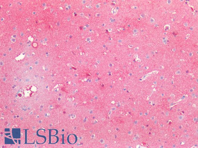 SSEA-1 / Lewis x / CD15 Antibody - Human Brain, Cortex: Formalin-Fixed, Paraffin-Embedded (FFPE)