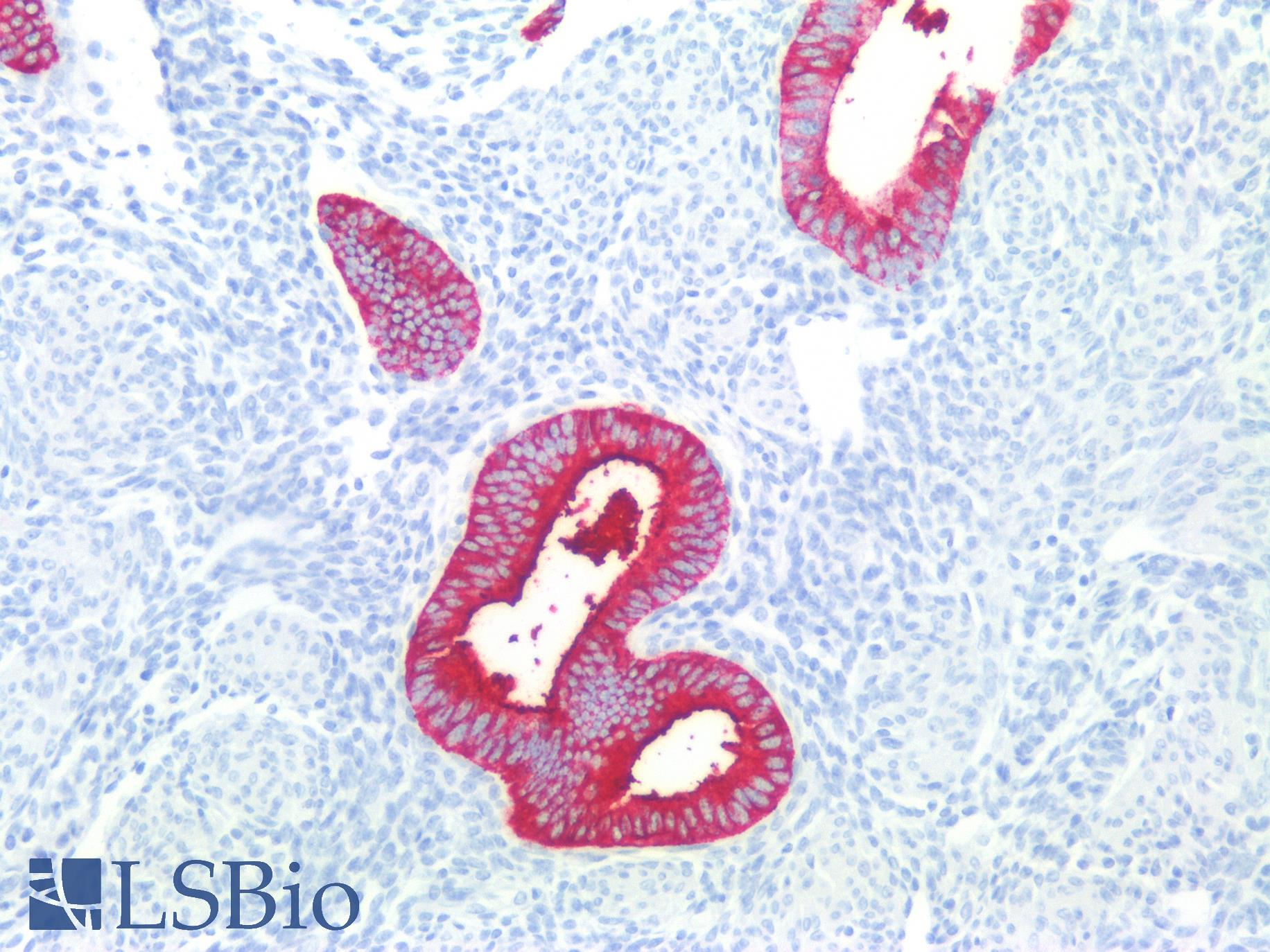 SSEA-1 / Lewis x / CD15 Antibody - Human Uterus: Formalin-Fixed, Paraffin-Embedded (FFPE)