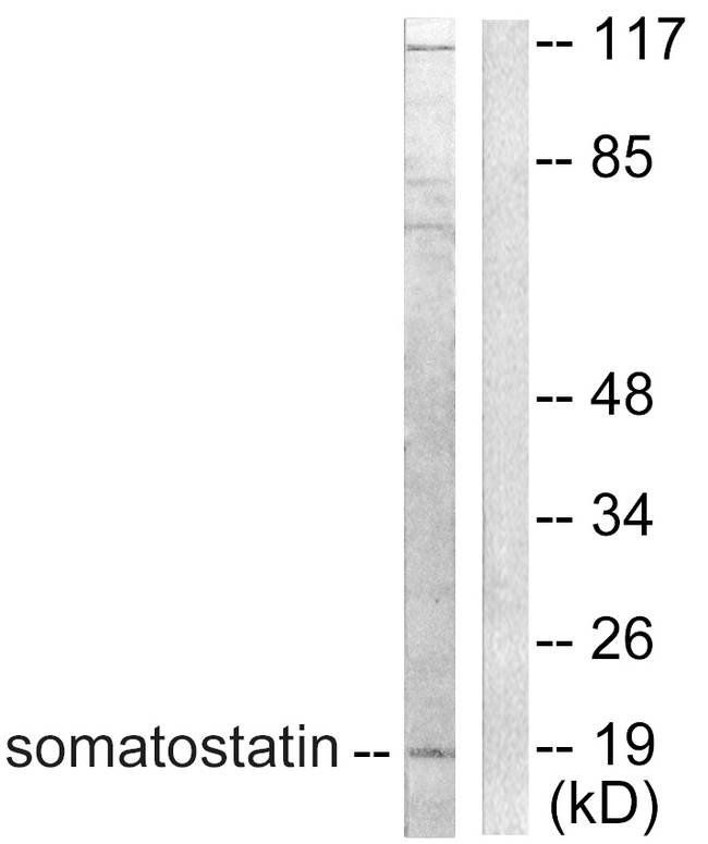SST / Somatostatin Antibody - Western blot analysis of lysates from A549 cells, using Somatostatin Antibody. The lane on the right is blocked with the synthesized peptide.