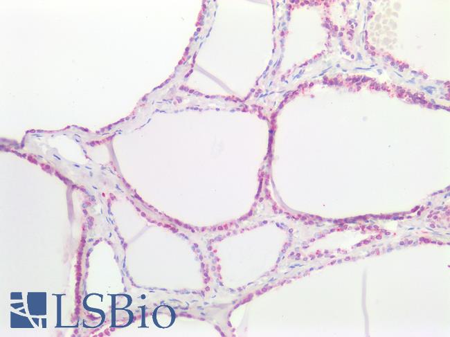 SSTR4 Antibody - Human Thyroid: Formalin-Fixed, Paraffin-Embedded (FFPE)