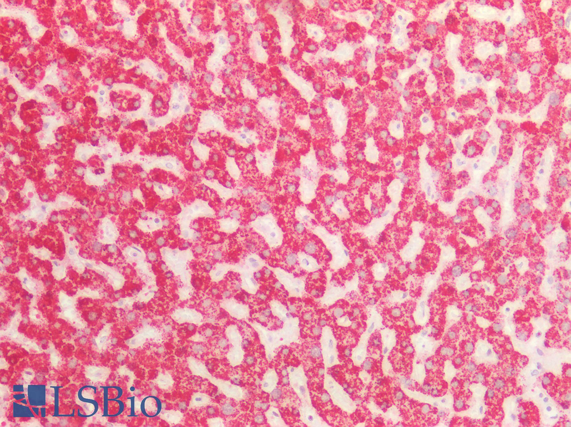 ST6GAL1 / CD75 Antibody - Human Liver: Formalin-Fixed, Paraffin-Embedded (FFPE)