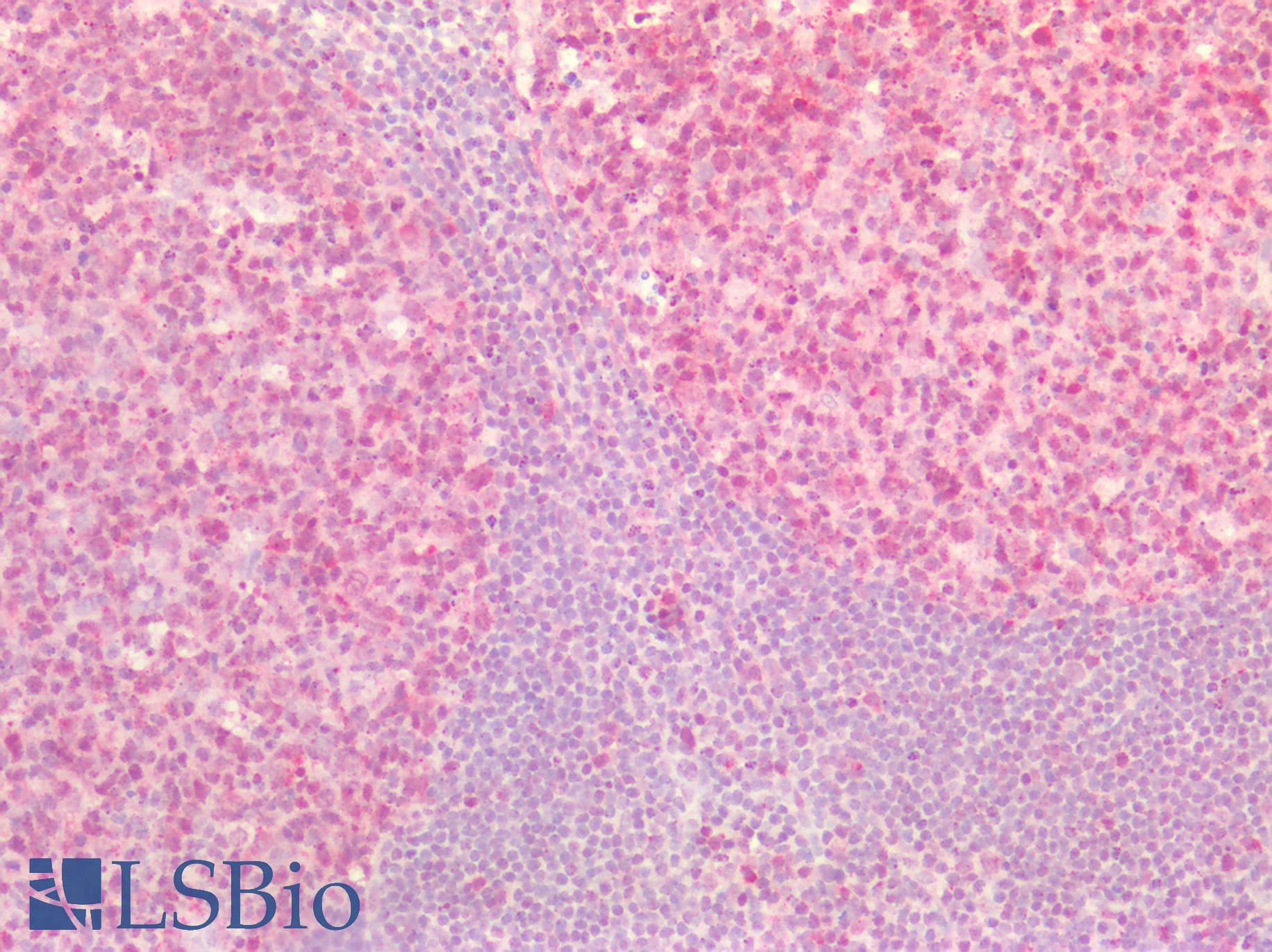 ST6GAL1 / CD75 Antibody - Human Tonsil: Formalin-Fixed, Paraffin-Embedded (FFPE)