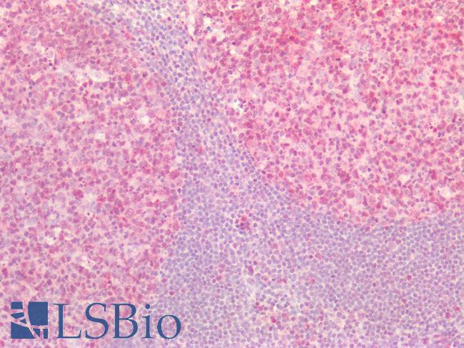 ST6GAL1 / CD75 Antibody - Human Tonsil: Formalin-Fixed, Paraffin-Embedded (FFPE)