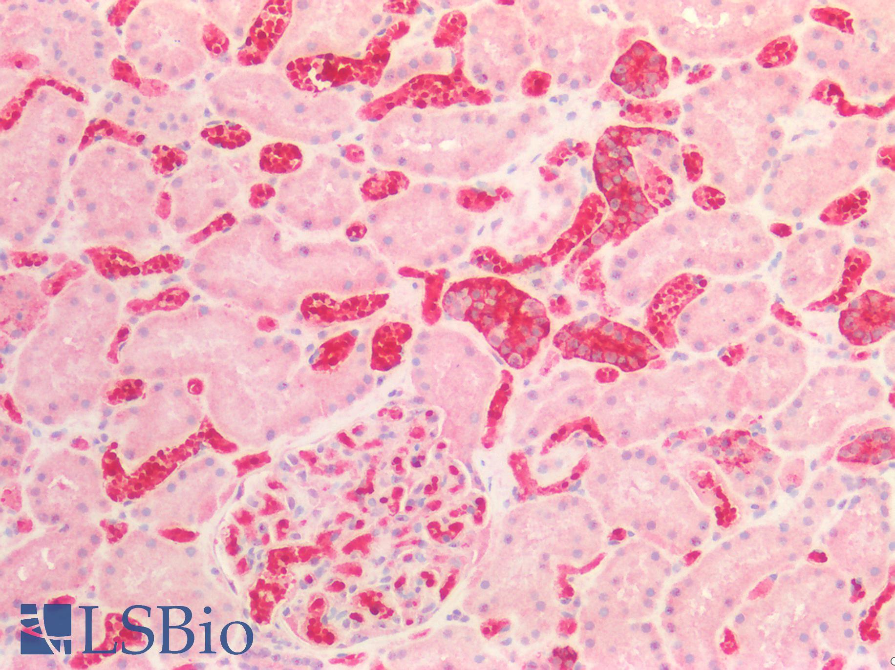 ST6GAL1 / CD75 Antibody - Human Kidney: Formalin-Fixed, Paraffin-Embedded (FFPE)
