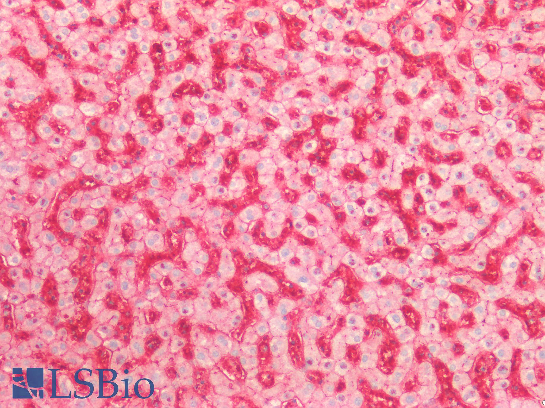 ST6GAL1 / CD75 Antibody - Human Liver: Formalin-Fixed, Paraffin-Embedded (FFPE)